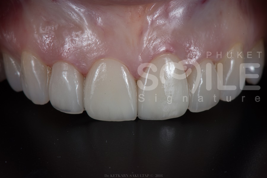 phuket smile dental clinic