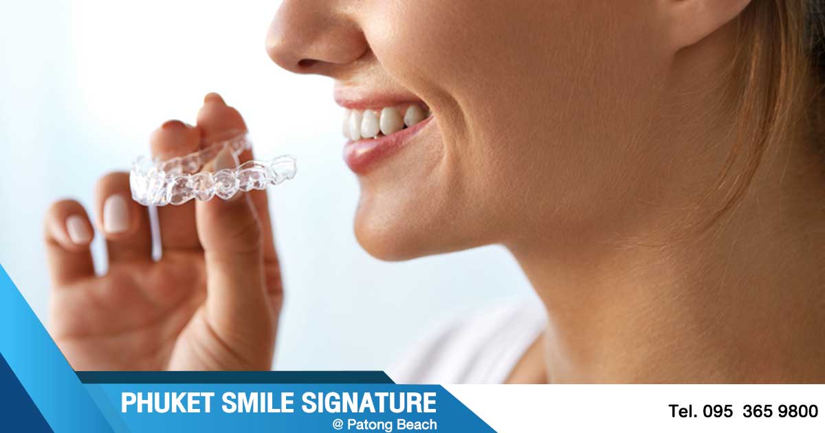 Phuket Orthodontics Invisalign Braces Patong Dental Clinic