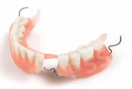 metal frame partial denture
