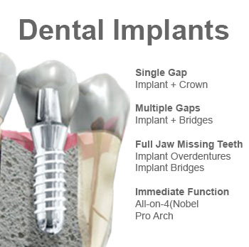 phuket dental implant