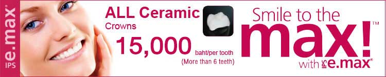 promotion dental crowns phuket